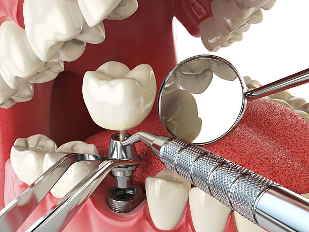 Reliable AL Emergency Dentist Solutions