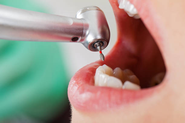 Best After-Hours Emergency Dentist in Decatur, AL